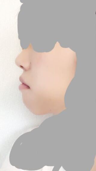 横顔ぶすです 昔から口元がコンプレックスです 出っ歯ではないのですが Yahoo 知恵袋