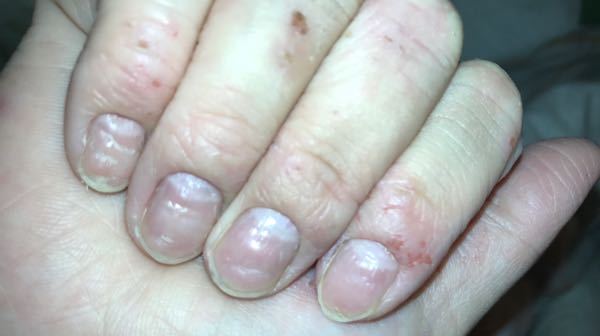 画像のように爪 手荒れが酷く 爪がデコボコしています この状態での自爪ネイル Yahoo 知恵袋