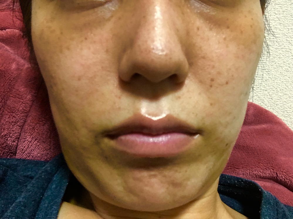 24歳の女です 24歳にしては肌が汚いと思いコンプレックスです メイ Yahoo 知恵袋