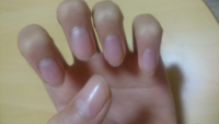 ネイリストの方はみんな自爪がキレイなのですか？後、どうしたら爪がキレイになりますか。下の画像は私の爪です。 
