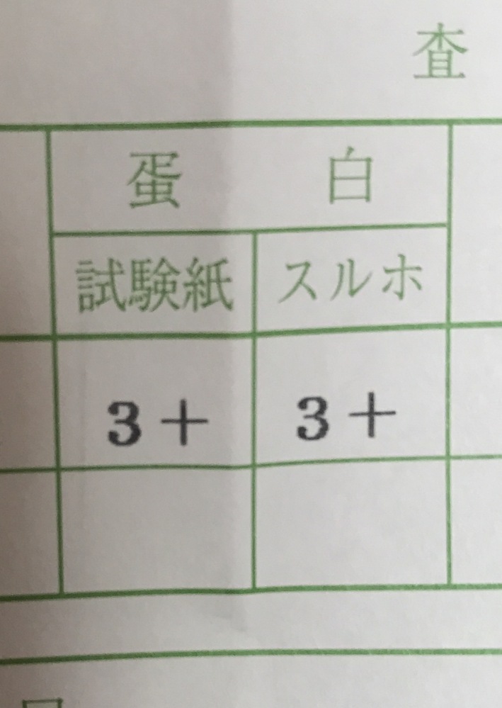 尿 検査 オナニー
