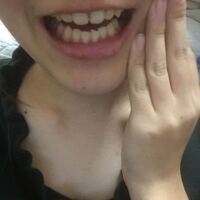 歯列矯正してこの歯並びってやばいですよね マウスクリーナーサボっててこうなりま Yahoo 知恵袋