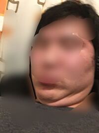 顔の肉がやばいです 異常ですよね 痩せたいです 身長180の体重96なの Yahoo 知恵袋