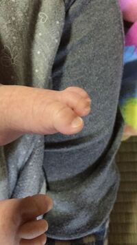 赤ちゃんの爪について 生後1ヶ月半くらいの息子の足の爪の すべての指の白い Yahoo 知恵袋