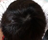 髪の毛って一体何本あるの 毎日かなりの数が抜けるけどハゲないか心 Yahoo 知恵袋