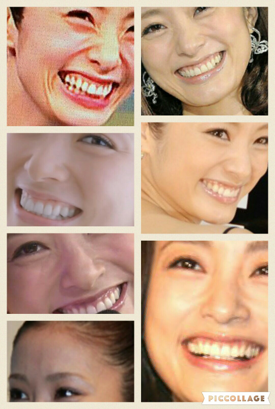 上戸彩笑うと歯茎出て 口元ぬめぬめだね Yahoo 知恵袋