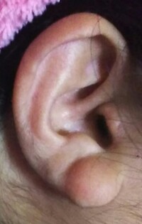 ホンマでっか ｔｖ女性の耳幅が広いと何 がばがば膣の大きさと幅が比 Yahoo 知恵袋