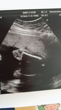 3人目も男の子だった方 ショックでしたか 私は3人目が欲しいです Yahoo 知恵袋