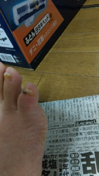 観覧注意です これは 爪水虫が悪化して黒くなったのでしょうか Yahoo 知恵袋
