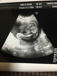 妊娠7ヶ月の妊婦です 赤ちゃんのエコー写真を頂きましたが 性別を知り Yahoo 知恵袋