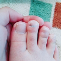 この爪の黒いのって大丈夫ですか 人差し指の爪の付け根が黒いのですが Yahoo 知恵袋