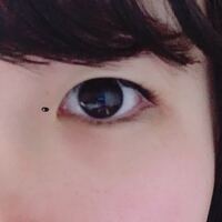 目の位置を下げる整形ってありませんか 目尻ならある程度は 眼球の位置は Yahoo 知恵袋