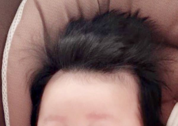 赤ちゃんの髪の毛について 生後2ヶ月の娘がいます 髪の量がとてつもなく多い Yahoo 知恵袋
