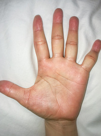 高校生です 私は手相がものすごく多くて ごちゃごちゃしています ど Yahoo 知恵袋