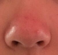 昔から豚鼻なのがコンプレックスです鼻筋も通ってないし 親からもよく鼻の Yahoo 知恵袋