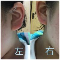フックタイプのピアスって 穴を開けてからどれくらいでつけても大丈夫ですか Yahoo 知恵袋
