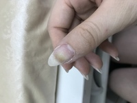 ジェルネイルを剥がしたら爪の色が変色している部分がありました なぜこ Yahoo 知恵袋