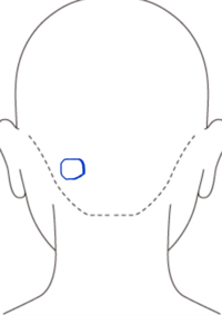 最近気がついたのですが 後頭部の 丸印 のあるところにしこり み Yahoo 知恵袋
