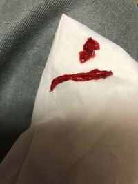 写真ありすいません 今生理2日目なんですがなんだかナプキンに赤いゼリー状な Yahoo 知恵袋