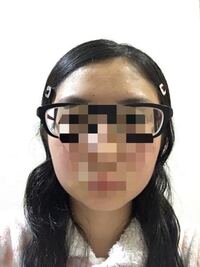 顔の輪郭が左右で違うくって 笑った時写真を見ると違和感を感じます Yahoo 知恵袋