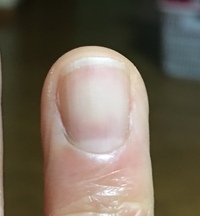 爪の真ん中が白っぽくなっている事に今日気づきました テレビで 指で爪 Yahoo 知恵袋
