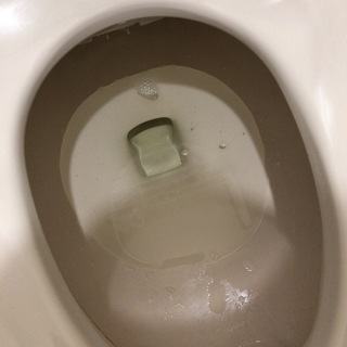 尿画像閲覧注意 本日から排尿をすると泡が残ることに気づいたのですが Yahoo 知恵袋