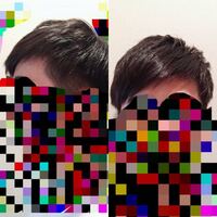 おでこに指が7本入りますがハゲた訳ではなく 小さい頃からずっと広すぎて Yahoo 知恵袋