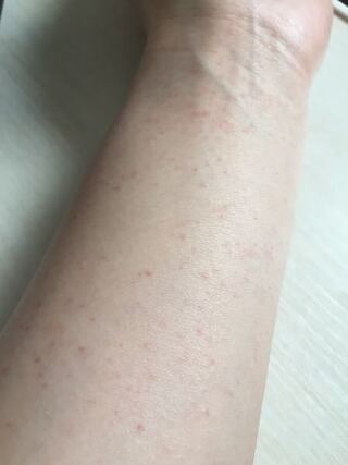 速記 ボット 置き場 赤い シミ 腕 Datarevival Jp