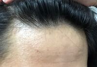 生え際の片方だけ薄く感じます これってハゲてますか まだ22歳 Yahoo 知恵袋