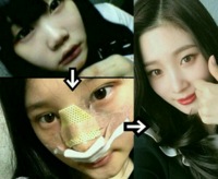 韓国人は美容整形なしでは生きられないのか この写真 幻滅する人がかなり Yahoo 知恵袋