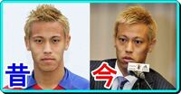 本田圭佑が昔と比べて明らかに別人のように顔が変わってますが彼は整形して Yahoo 知恵袋