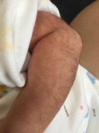 新生児 毛深い 毛深い赤ちゃんの原因は遺伝 我が子は一生 毛が濃いの