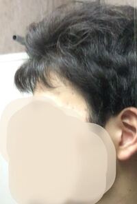フケに悩んでいます 前髪のあたりをかくとふけが出ます Yahoo 知恵袋