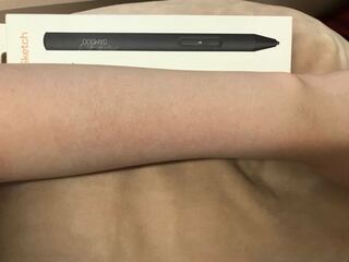 中学生です 肌に透明感を出す方法はありますか 小さい頃に火傷し Yahoo 知恵袋