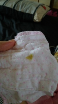 3ヶ月の娘の嘔吐物が黄緑色でした 今まで戻したときはクリーム色だったのに今回 Yahoo 知恵袋