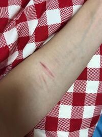 コンシーラーで傷跡は隠せますか おすすめのあったら教えてください Yahoo 知恵袋