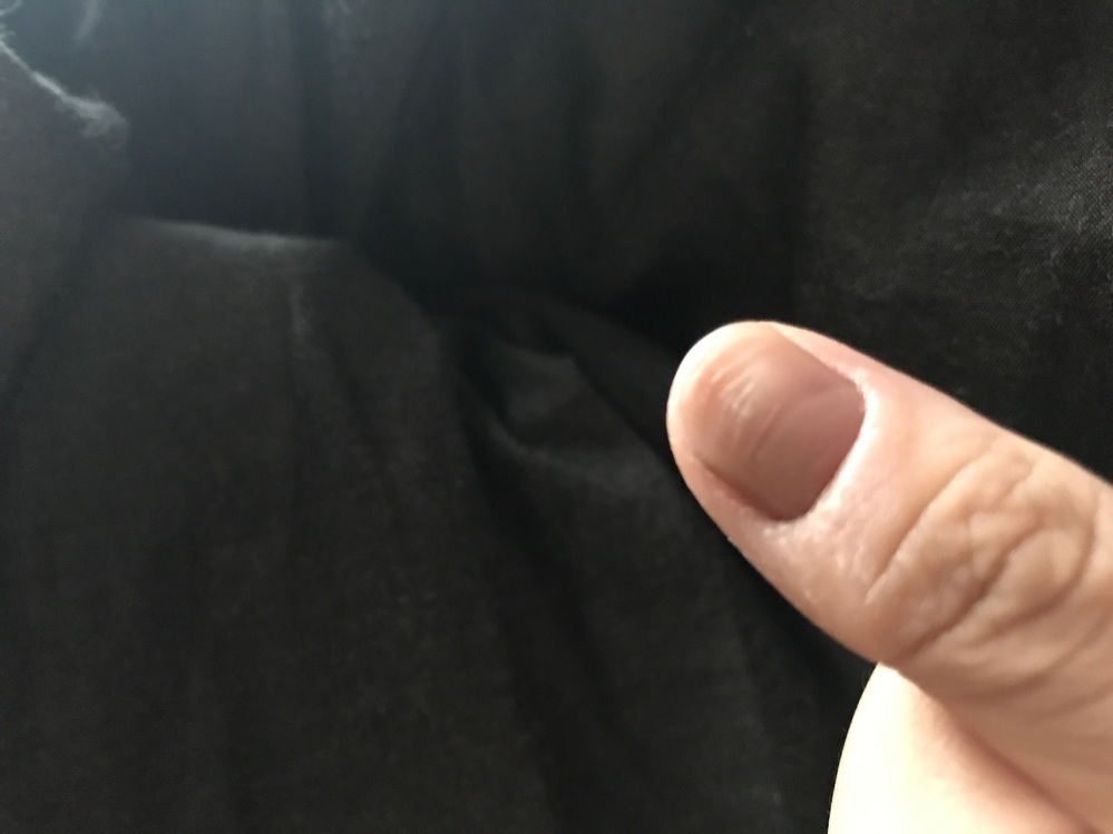 画像のように 私の左手の親指は一度爪が剥がれたということもあり他の爪より色が悪 Yahoo 知恵袋