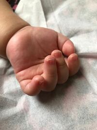 生後3ヶ月の赤ちゃんの爪について 薬指の爪の横が白くなって皮がむけてます Yahoo 知恵袋