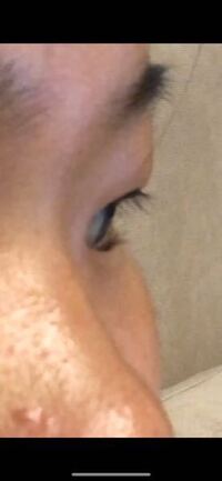 逆さまつげについて 画像見づらくて申し訳ないです 正面からとると Yahoo 知恵袋