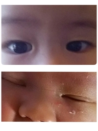 赤ちゃんの瞼にアイプチをしていると二重瞼になるって言っている方がいましたがこれ Yahoo 知恵袋