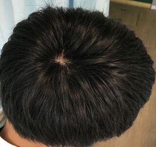 高校生です 最近つむじが気になってるのですが これは正常なつむじですか Yahoo 知恵袋