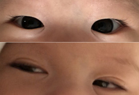4か月の赤ちゃんの目について瞼が分厚い限りなく一重のような奥二重をしています Yahoo 知恵袋