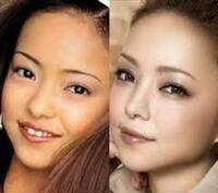 安室奈美恵さんって昔に比べて鼻がキレイになったような気がするんで Yahoo 知恵袋