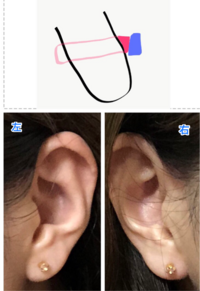この並びのピアスの開け方は見た目的にダサいでしょうか 自分 Yahoo 知恵袋