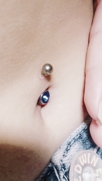 ピアスホール周辺の皮膚が剥がれます すごい酷いってわけでもないんですが 皮が Yahoo 知恵袋