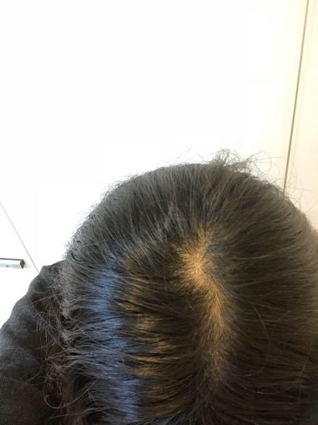 髪の分け目が気になります。 - 猫っ毛ですu2026薄いと思いますか？ - Yahoo 