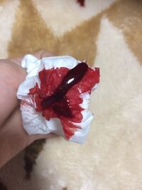 閲覧注意 小6女子です 生理中です お風呂から出て 部屋に行ったら血が Yahoo 知恵袋