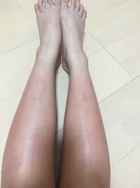 ボディクリームを塗ったら足が腫れました ヒリヒリして痛いです Yahoo 知恵袋