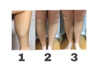 手に力が入らない 至急 こんにちは 中学生です 題名通り 手に力が入らない Yahoo 知恵袋