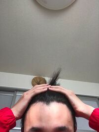 これはえむ字はげですか 富士額ですか 昔から真ん中の富士山 見たいのが目 Yahoo 知恵袋